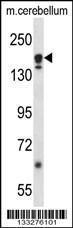 Anti-ATG2A Rabbit Polyclonal Antibody (AP (Alkaline Phosphatase))