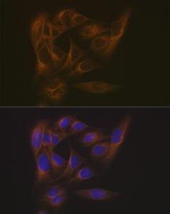 Anti-EB3 antibody