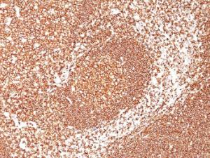 Immunohistochemical analysis of formalin-fixed, paraffin-embedded human tonsil using Anti-CD45 Antibody [2B11 + PD7/26]