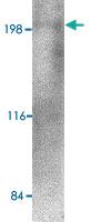 Anti-RGPD5 Rabbit Polyclonal Antibody