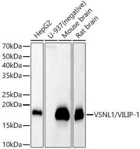 Western blot analysis of various lysates, using Anti-VILIP1 Antibody (A11565) at 1:400 dilution