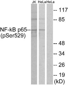 Western blot analysis of lysates from HeLa and Jurkat cells using Anti-NF-kappaB p65 (phospho Ser529) Antibody. The right hand lane represents a negative control, where the antibody is blocked by the immunising peptide.