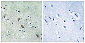 Immunohistochemical analysis of paraffin-embedded human brain tissue using Anti-HtrA2 Antibody. The right hand panel represents a negative control, where the antibody was pre-incubated with the immunising peptide.