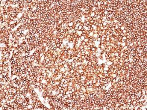 Immunohistochemical analysis of formalin-fixed, paraffin-embedded human tonsil using Anti-CD45 Antibody [2B11 + PD7/26]