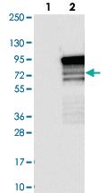 Anti-TBC1D14 Rabbit Polyclonal Antibody