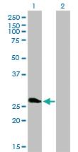 Anti-RNF114 Mouse Monoclonal Antibody [clone: 4G3-1A10]