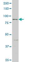 Anti-RIPK4 Mouse Monoclonal Antibody [clone: 1G2]