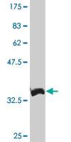 Anti-XBP1 Mouse Monoclonal Antibody [clone: 3F5]