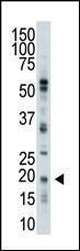 Anti-UBE2C Rabbit Polyclonal Antibody (AP (Alkaline Phosphatase))