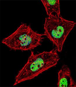 Anti-ROR alpha Rabbit Polyclonal Antibody