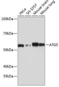 Anti-APG5L/ATG5 Rabbit Monoclonal Antibody [clone: ARC0156]