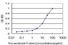 Anti-RIPK4 Mouse Monoclonal Antibody [clone: 1G2]