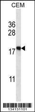 Anti-EIF5A2 Rabbit Polyclonal Antibody (HRP (Horseradish Peroxidase))