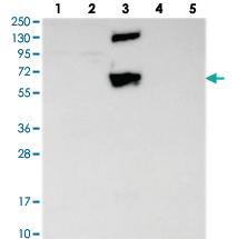 Anti-CEP70 Rabbit Polyclonal Antibody