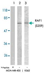 Anti-RAF1 Rabbit Polyclonal Antibody