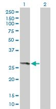 Anti-THEM4 Mouse Polyclonal Antibody