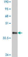 Anti-CNR1 Mouse Polyclonal Antibody