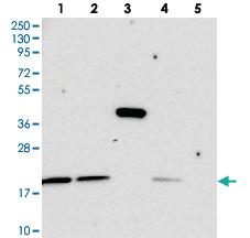 Anti-C11ORF57 Rabbit Polyclonal Antibody