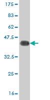 Anti-LHX6 Mouse Monoclonal Antibody [clone: 1B11]