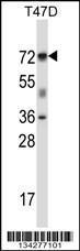 Anti-FOXK2 Rabbit Polyclonal Antibody (PE (Phycoerythrin))