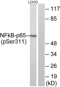 Anti-NF-kB p65 Rabbit Polyclonal Antibody