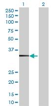 Anti-TBC1D21 Mouse Polyclonal Antibody