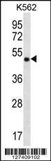 Anti-CCDC71 Rabbit Polyclonal Antibody (Biotin)