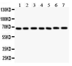 Anti-GAD67 Polyclonal Antibody