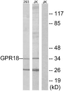 Western blot analysis of lysates from 293 and Jurkat cells using Anti-GPR18 Antibody. The right hand lane represents a negative control, where the antibody is blocked by the immunising peptide