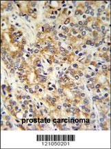 Anti-TXNDC12 Rabbit Polyclonal Antibody