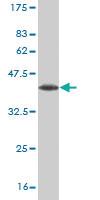 Anti-LHX6 Mouse Monoclonal Antibody [clone: 3E8]