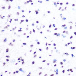 Immunohistochemistry analysis of paraffin-embedded rat brain using Anti-Histone H2A Antibody [ARC0253] (A306399) at a dilution of 1:100 (40x lens). Perform microwave antigen retrieval with 10 mM PBS buffer pH 7.2 before commencing with IHC staining protocol.