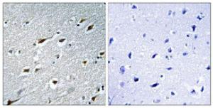 Immunohistochemical analysis of paraffin-embedded human brain tissue using Anti-HAND1 Antibody. The right hand panel represents a negative control, where the Antibody was pre-incubated with the immunising peptide