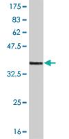 Anti-CNR1 Mouse Monoclonal Antibody [clone: 2F9]