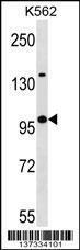 Anti-KLHL4 Rabbit Polyclonal Antibody (FITC (Fluorescein Isothiocyanate))