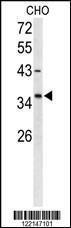 Anti-FOXL1 Rabbit Polyclonal Antibody (AP (Alkaline Phosphatase))