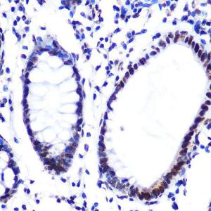 Immunohistochemistry analysis of paraffin-embedded human colon tissue using Anti-Histone H2A Antibody [ARC0253] (A306399) at a dilution of 1:100 (40x lens). Perform microwave antigen retrieval with 10 mM PBS buffer pH 7.2 before commencing with IHC staining protocol.