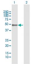 Anti-IGHG1 Rabbit Polyclonal Antibody