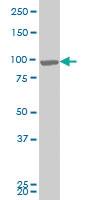 Anti-RIPK4 Mouse Monoclonal Antibody [clone: 4H5]