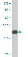 Anti-XBP1 Mouse Monoclonal Antibody [clone: 1E3]