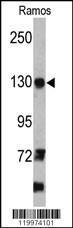 Anti-NGLY1 Rabbit Polyclonal Antibody