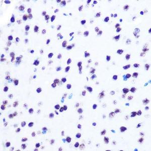 Immunohistochemistry analysis of paraffin-embedded mouse brain using Anti-Histone H2A Antibody [ARC0253] (A306399) at a dilution of 1:100 (40x lens). Perform microwave antigen retrieval with 10 mM PBS buffer pH 7.2 before commencing with IHC staining protocol.