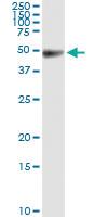 Anti-IGHG1 Rabbit Polyclonal Antibody