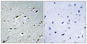 Immunohistochemical analysis of paraffin-embedded human brain using Anti-HAND1 Antibody 1:100 (4 °C overnight). The right hand panel represents a negative control, where the Antibody was pre-incubated with the immunising peptide