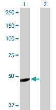 Anti-IGHG1 Rabbit Polyclonal Antibody