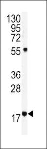 Anti-UBE2D1 Rabbit Polyclonal Antibody (APC (Allophycocyanin))