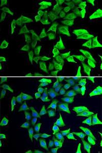 Immunofluorescence analysis of U2OS cells using Anti-VILIP1 Antibody (A11565). DAPI was used to stain the cell nuclei (blue)