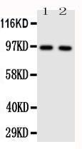 Anti-TLR4 Polyclonal Antibody