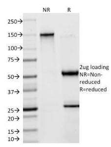 SDS-PAGE analysis of Anti-Creatine Kinase BB Antibody [2ba6] under non-reduced and reduced conditions; showing intact IgG and intact heavy and light chains, respectively. SDS-PAGE analysis confirms the integrity and purity of the antibody