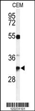 Anti-TSPAN7 Rabbit Polyclonal Antibody